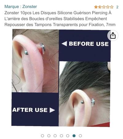 Dětské nemoci | Keloid u miminka
