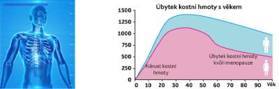 Zdravotní potíže dospělých | Osteoporoza