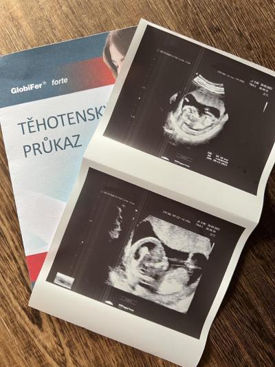 Těhotenství | TP prosinec 2023