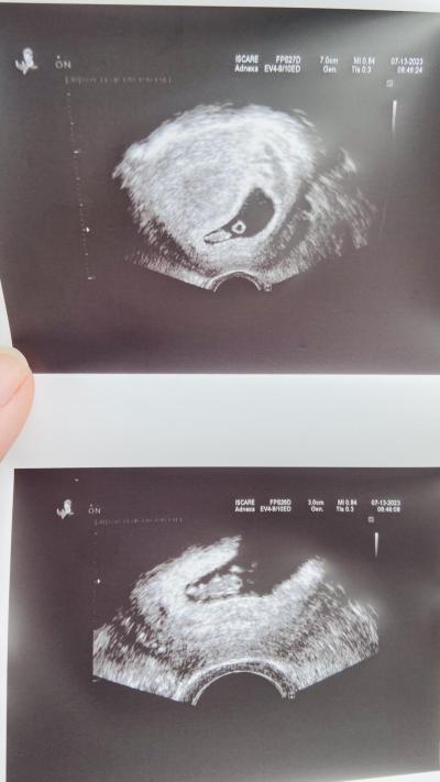 Centra asistované reprodukce | IVF 2023