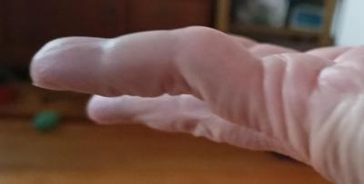 Zdravotní potíže dospělých | K lékaři v pracovní době - poraďte