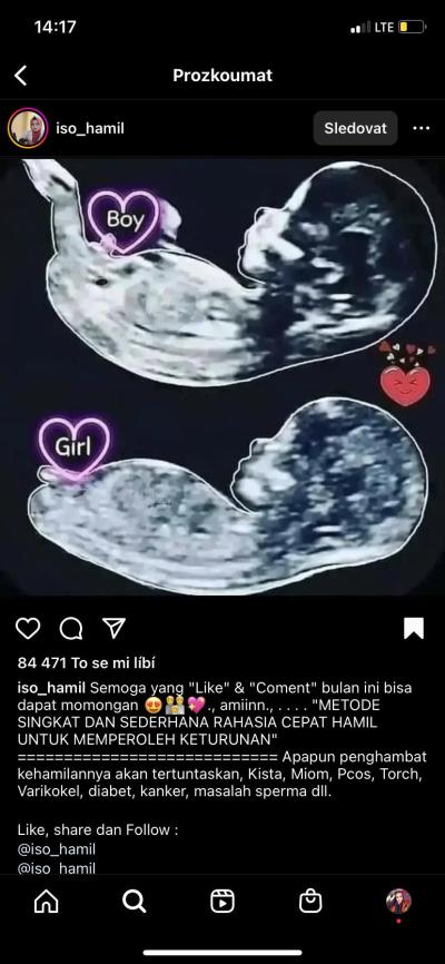Těhotenství | Co vidite holcicku/chlapecka?