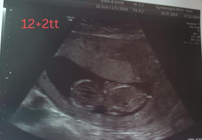 Centra asistované reprodukce | IVF 2023