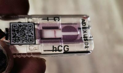 Testování a těhotenský test | Váš názor na těhotenský test
