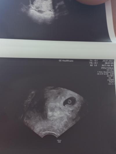 Centra asistované reprodukce | IVF 2023