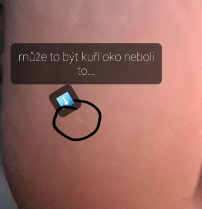 Zdravotní potíže dospělých | Kuří oko 2023