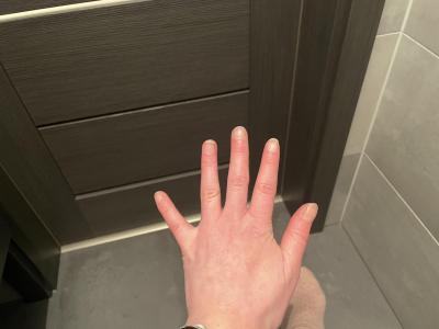 Zdravotní potíže dospělých | Je tohle normalni tres?