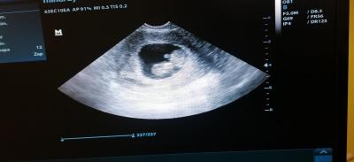 Centra asistované reprodukce | IVF 2022/2023