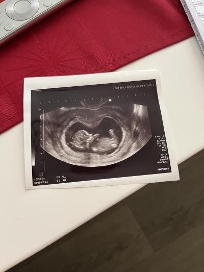 Centra asistované reprodukce | IVF 2023