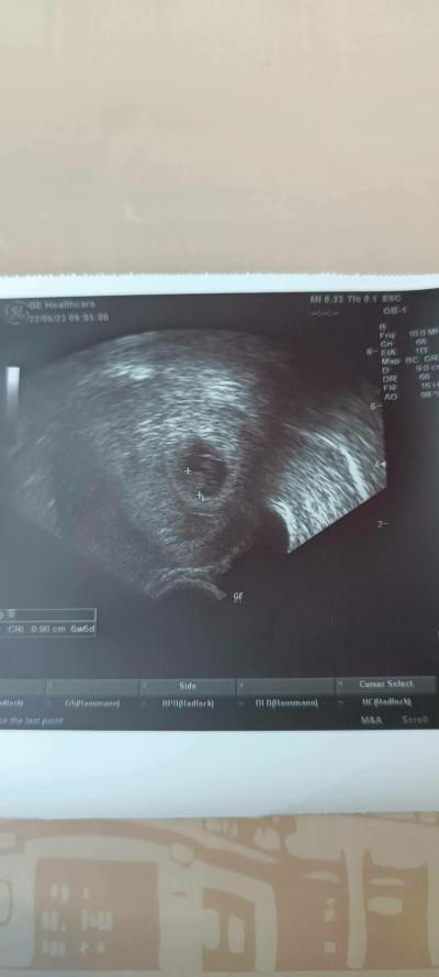 Centra asistované reprodukce | IVF 2023