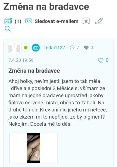 Zdravotní potíže dospělých | Je toto normální barva?