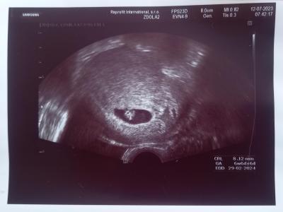 Centra asistované reprodukce | IVF 2023