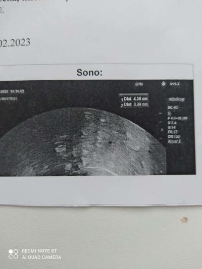 Lékaři, nemocnice a zdravotnická zařízení | Pravidelné gynekologické prohlídky - ultrazvuk