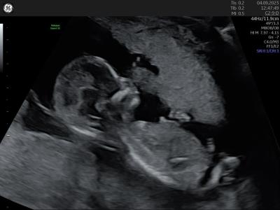 Centra asistované reprodukce | IVF 2023
