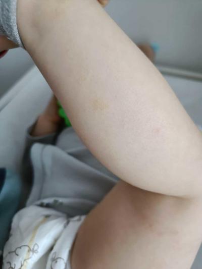 Před 