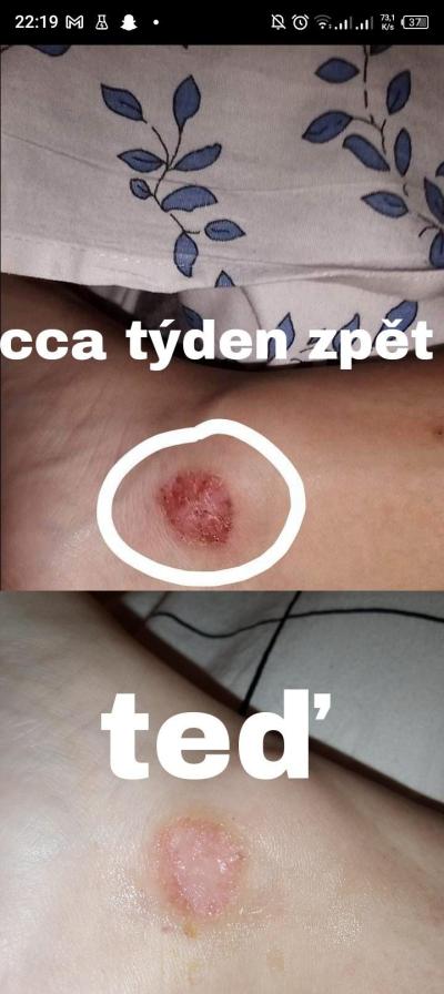 Alergie a ekzémy | Kožní problémy - svědivé