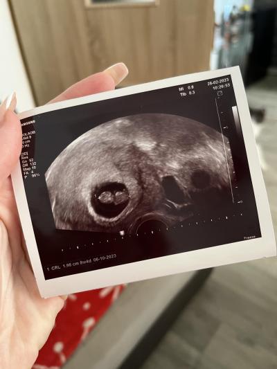 Centra asistované reprodukce | IVF 2023