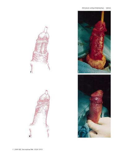 PDF_4