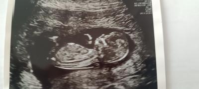 Centra asistované reprodukce | IVF 2023