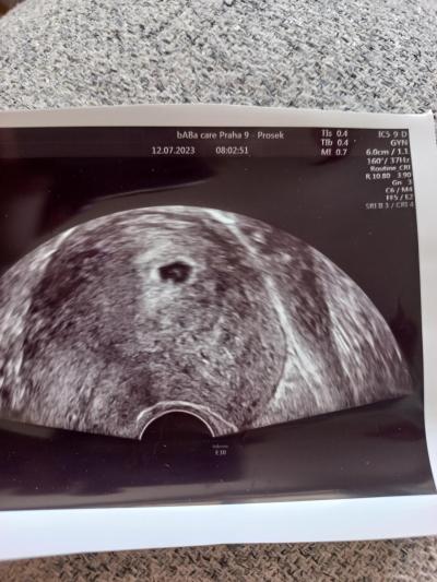 Centra asistované reprodukce | IVF 2023