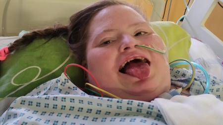 Pomoc pro Elišku: Mladá dívka s Downovým syndromem přišla o obě nohy