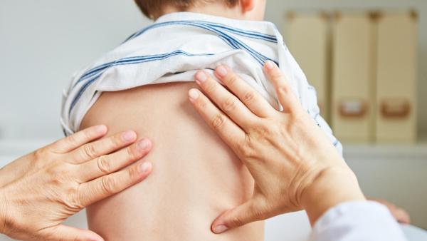 Jak se diagnostikuje Scheuermannova choroba?