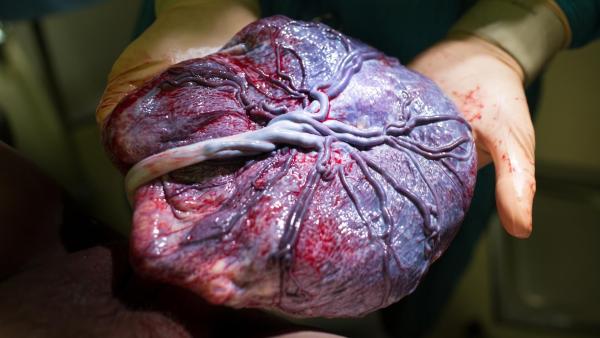 Jak se rodí placenta?