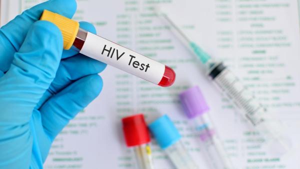 Příznaky HIV infekce. Jaké zkušenosti mají uživatelky eMimina?