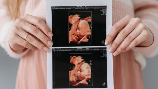 Problémy s placentou mohou zůsobit závažné komplikace.