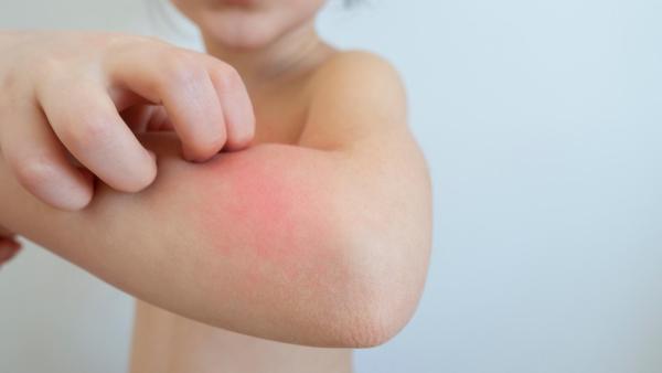 Jaké zkušenosti s kopřivkou mají uživatelky eMimina?