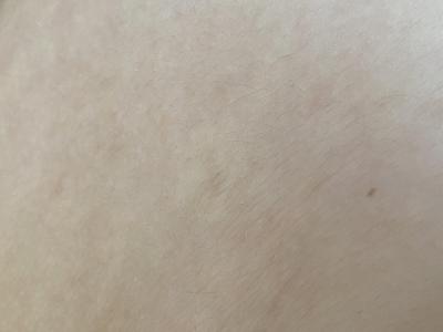Zdravotní potíže dospělých | Jsou to cesticky svrabu?