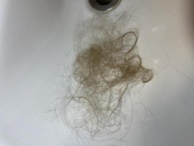 Zdravotní potíže dospělých | Nadměrné padání vlasů