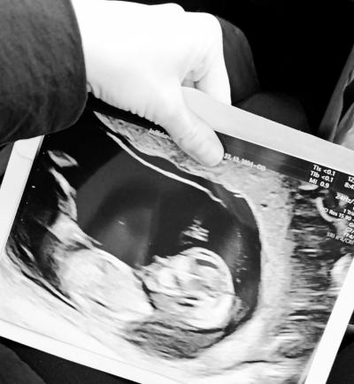 Těhotenství | Pohlaví, jaké si myslíte že čekáme?