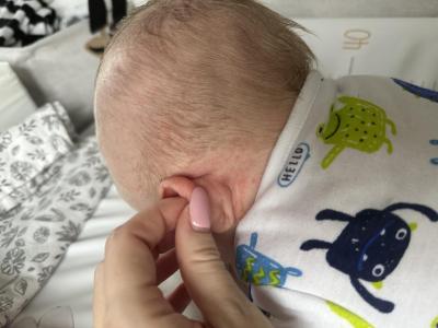 Alergie a ekzémy | Alergie nebo “obyčejný” ekzém, prosím?