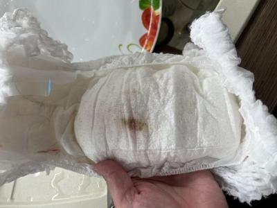 Batole (12 až 36 měsíců) | Růžový flek na plínce