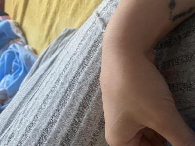 Zdravotní potíže dospělých | Boulička na ruce