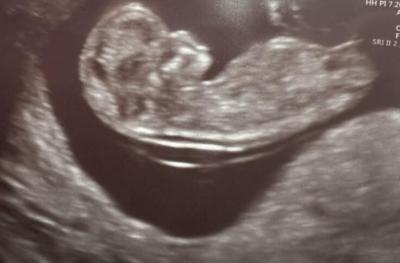 Těhotenství | Tipnete pohlaví?