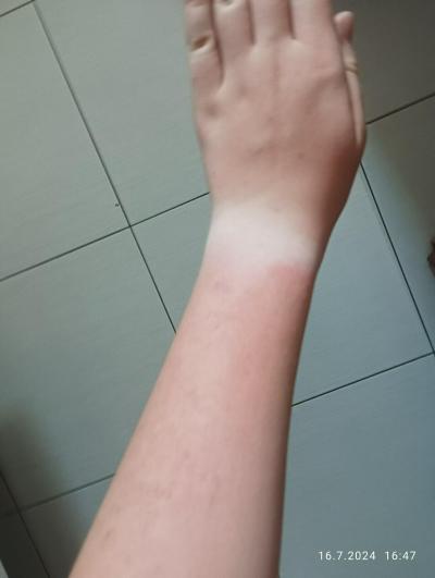 Kosmetika a hygienické potřeby | Opalování vs hodinky