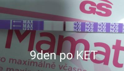Centra asistované reprodukce | IVF srpen 2024