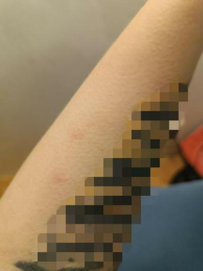 Zdravotní potíže dospělých | Svědění těla, játra?