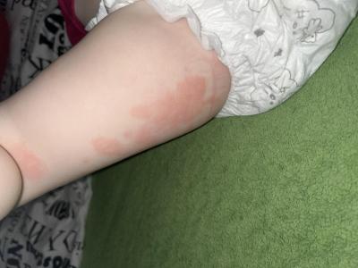 Batole (12 až 36 měsíců) | Exem nebo plíseň?