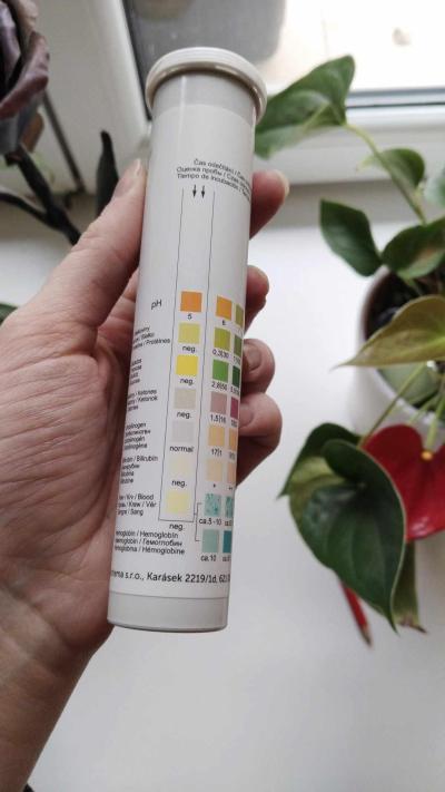 Dětské nemoci | Test moči u dětí