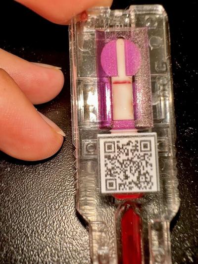 Těhotenství | Krevní test Innova Pharma