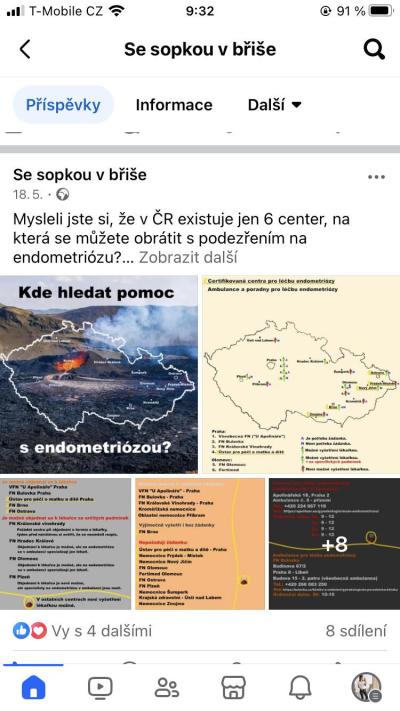 Gynekologické potíže | Křečové žíly v děloze