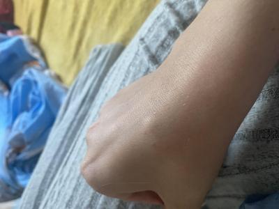 Zdravotní potíže dospělých | Boulička na ruce