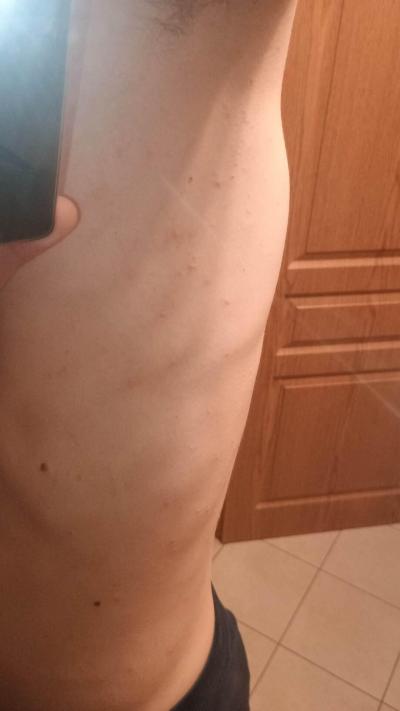 Alergie a ekzémy | Vyrážka / pupínky, svědění...