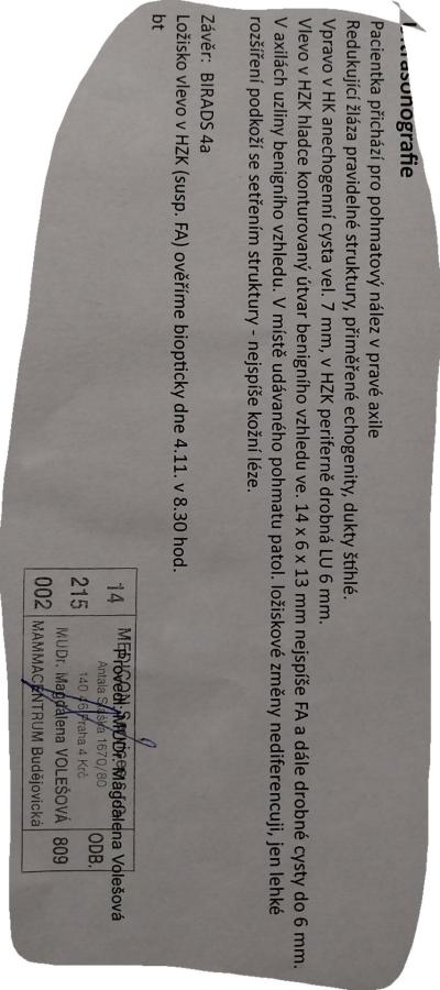 Zdravotní potíže dospělých | Utz prsu a hned nález, podělím se o 