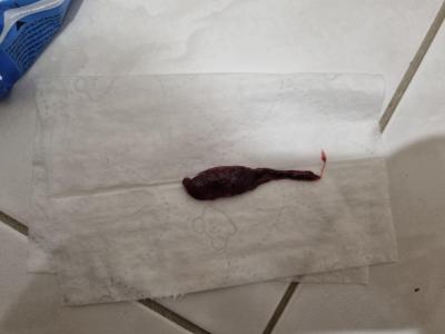 Gynekologické potíže | Sliznice?nebo neco jineho
