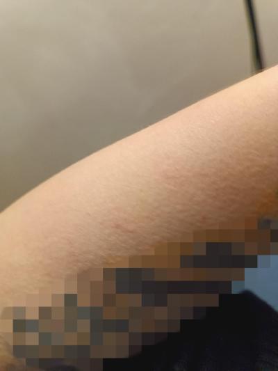 Zdravotní potíže dospělých | Svědění těla, játra?