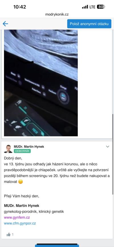 Těhotenství | Holka nebo kluk? UTZ 13+1